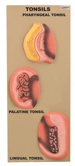 Model Tonsils