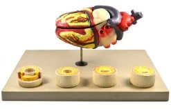 Model Of Human Heart Conditions Pathology; Larger Than Life Size (10"); Artery Cross Sections 2.5" In Diameter