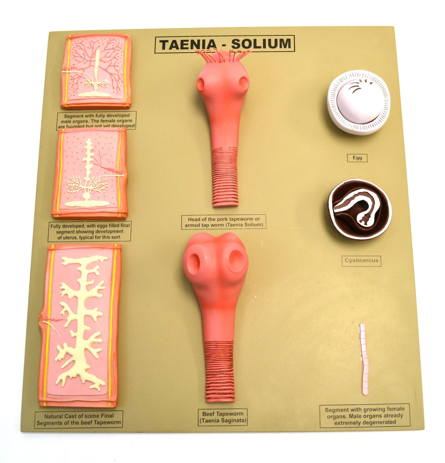 Tapeworm/Taenia-Solium Model, 20 Inch - Features 8 Stages 1 Tapeworm/Taenia-Solium Model, 20 Inch - Features 8 Stages