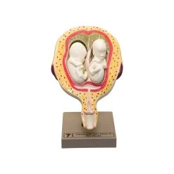 Human Embryo/Fetus Development In Utero, Set Of 8 Models -Laboratory Instrument Store ksh8l8gtpve7y5xtouzw